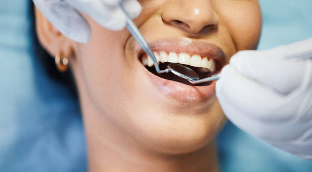 Best Broken or Chipped Tooth Repair in Towanda, PA