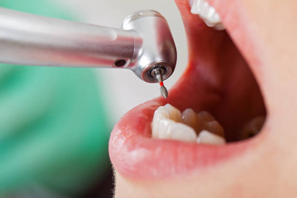 Best Emergency Treatment for Oral Infections in Towanda, PA